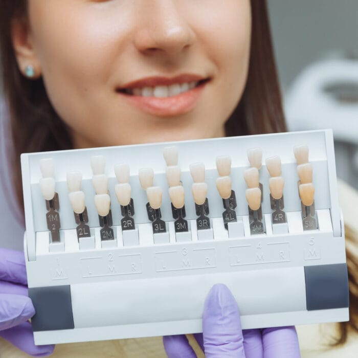 Dentist examining various types of dental veneers for patient treatment options.