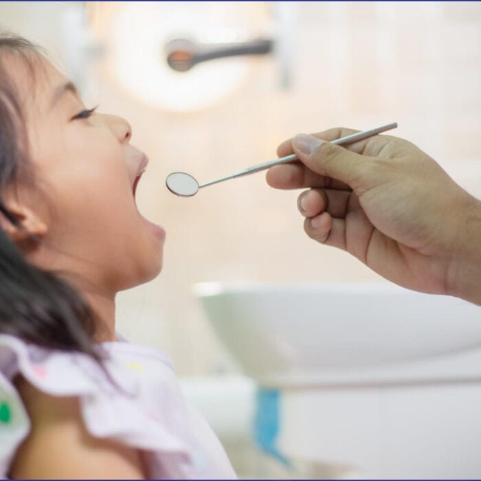 A pediatric dentist examining a child's open mouth, with the dentist's gloved hand gently holding a dental mirror, and bright clinic lighting in the background.